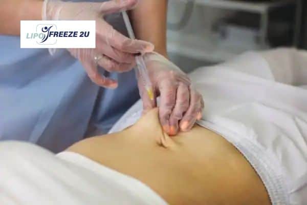 Fat Dissolving Injections Huddersfield & Weight loss medication
