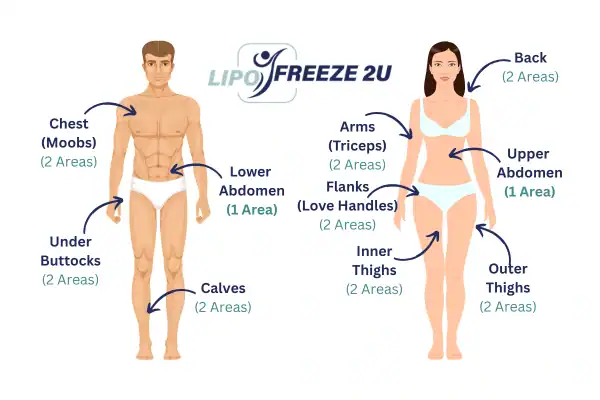 Areas you can have fat freezing treatment Huddersfield