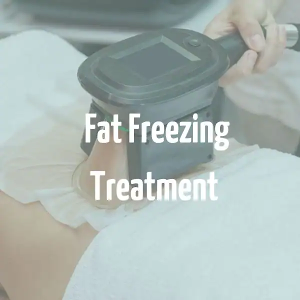 fat freezing treatment Huddersfield