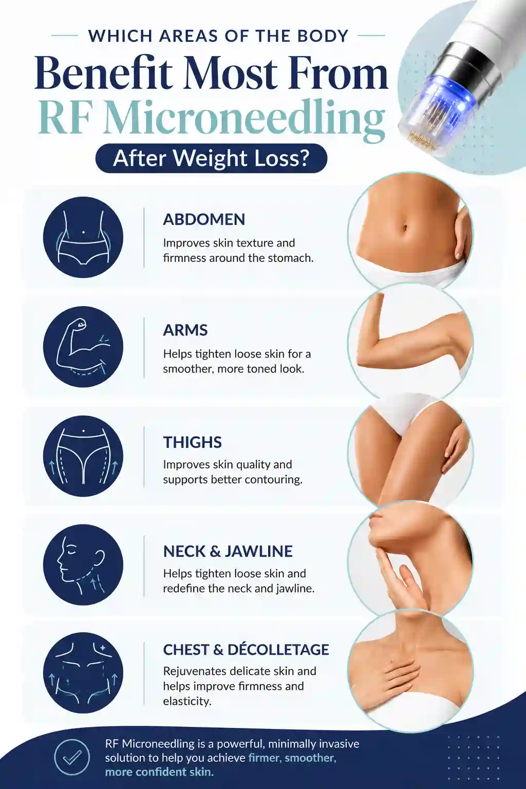 Which Areas of the Body Benefit Most From RF Microneedling After Weight Loss Huddersfield